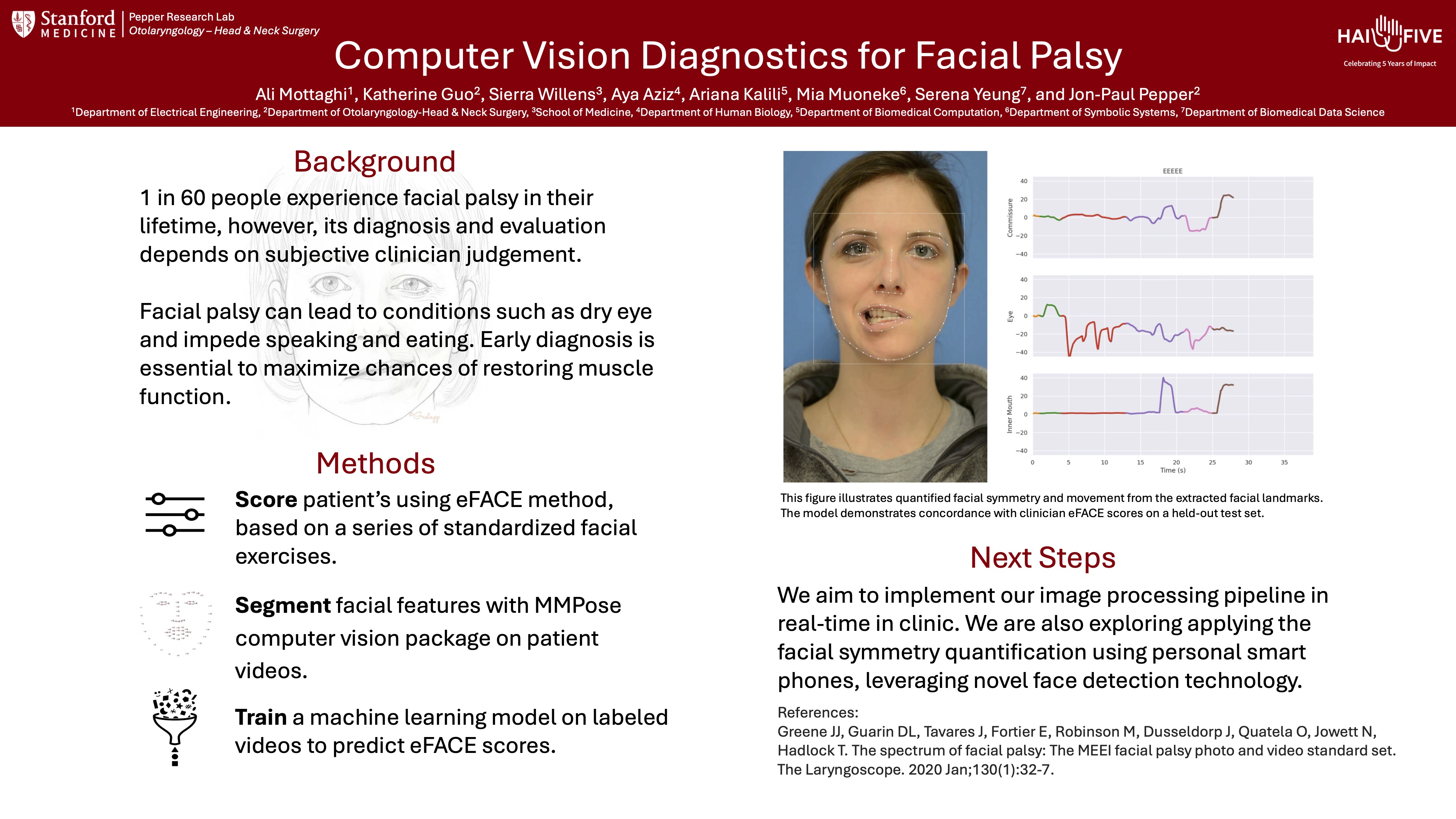 screenshot of poster for Computer Vision Diagnostics for Facial Palsy